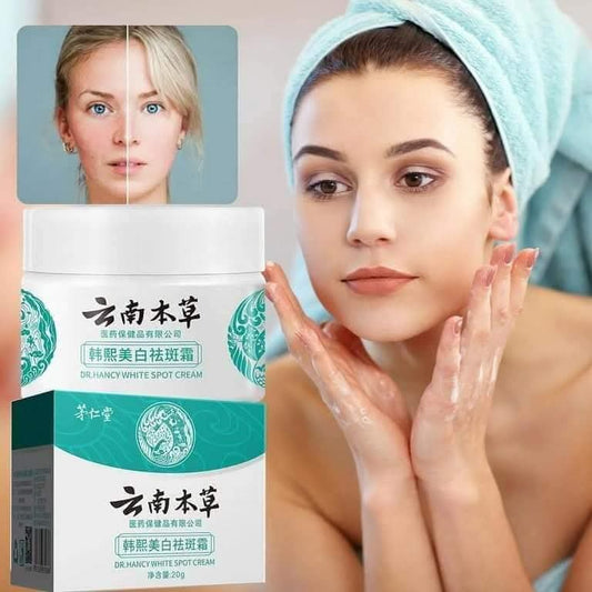 Japanese Melasma Cream, Dr Hancy White Spot Cream, China Dr. Hancy White Spot Cream, Dark Spot Corrector Cream, Dr Hancy White Spot Cream De China for Dry & Sensitive Skin (3pcs)